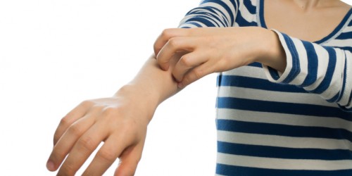 Medicinal And Natural Ways to Treat Contact Dermatitis